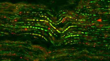 Trigeminal research