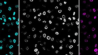 RINGs of DNA damage in human cells caused by the typhoid toxin underlying typhoid fever
