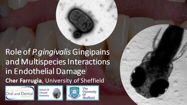 Slide of project on Gingipains and Endothelial Damage