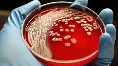 MRSA in a petri dish