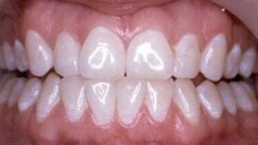 Example of a healthy mouth