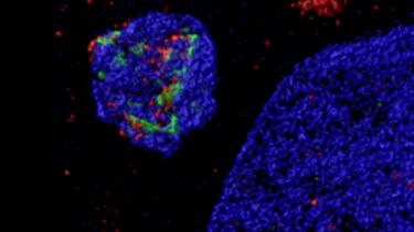 STED imaging of membrane repair proteins ESCRT-III accumulating at a micronucleus in a HeLa cell (red:CHMP7; green:CHMP4B; blue:DAPI). Willan J, et al Oncogenesis. 2019 Apr 15;8(5):29. doi: 10.1038/s41389-019-0136-0.