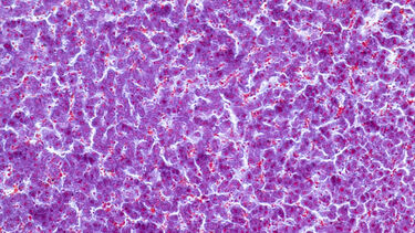 Liver tissue under a microscope