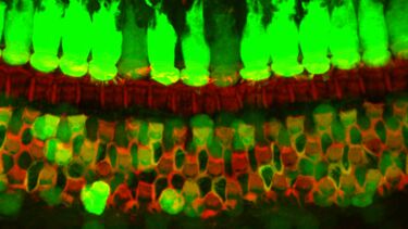 GFP