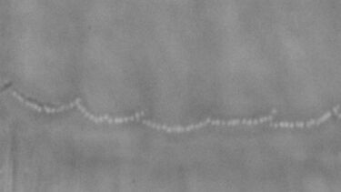 Stereocilia
