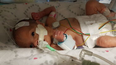 Baby tamlin in an incubator