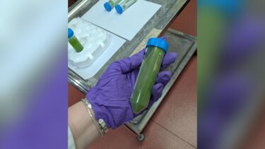 A tube of algae is being held by a hand wearing a purple lab glove