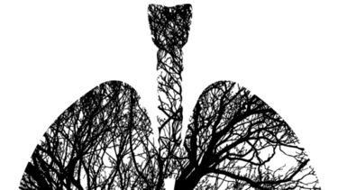 Image of lungs