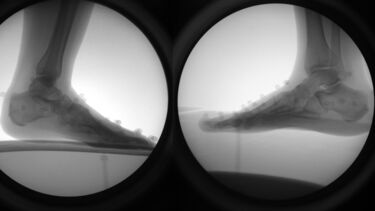 xray images of the foot and ankle