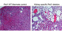Cyst progression in vivo