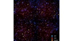 Ex-vivo high-throughput drug screening in bladder cancers