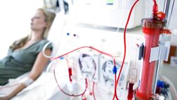 A woman receiving kidney dialysis treatment.