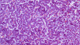 Liver tissue under a microscope